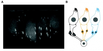 Gekoppelte Haarsinneszellen: (links) Fluoreszenzmikroskopische Aufnahme eines Zellverbands; (rechts) Zellverband von drei gekoppelten inneren Haarsinneszellen  Links: Institut für Auditorische Neurowissenschaften / UMG; rechts: Quelle: Jean et al., Nat Commun, 2020; Suppl. Part